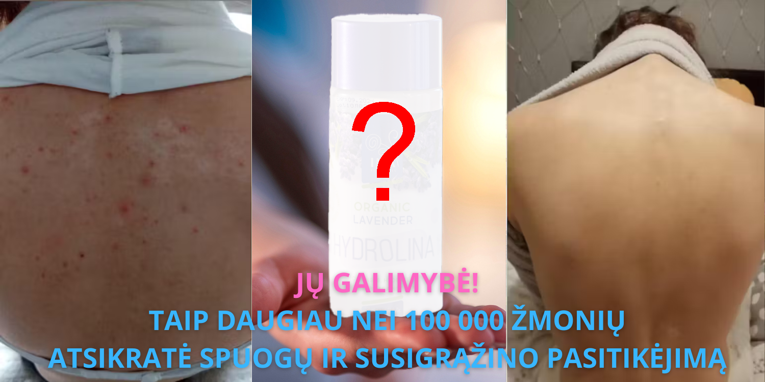 Kaip Daugiau nei 100 000 europiečių Pašalino Spuogus nuo Nugaros be Vaistų 3 Paprastais Žingsniais su Levandų Vandeniu