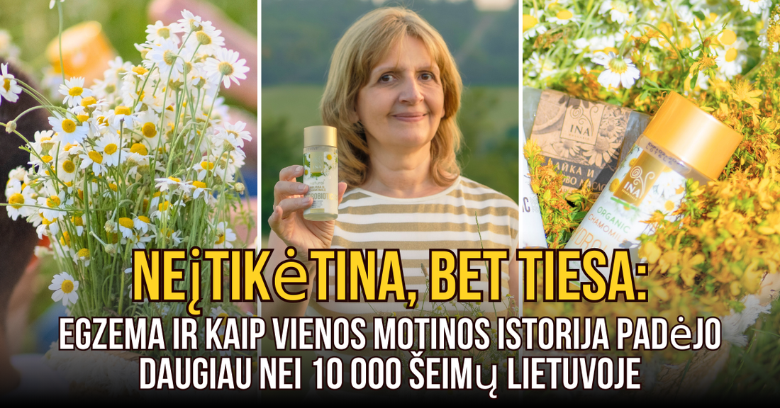 Kaip Motina Padėjo Vaikui Įveikti Egzemą Naudodama Stebuklingą Vandenį