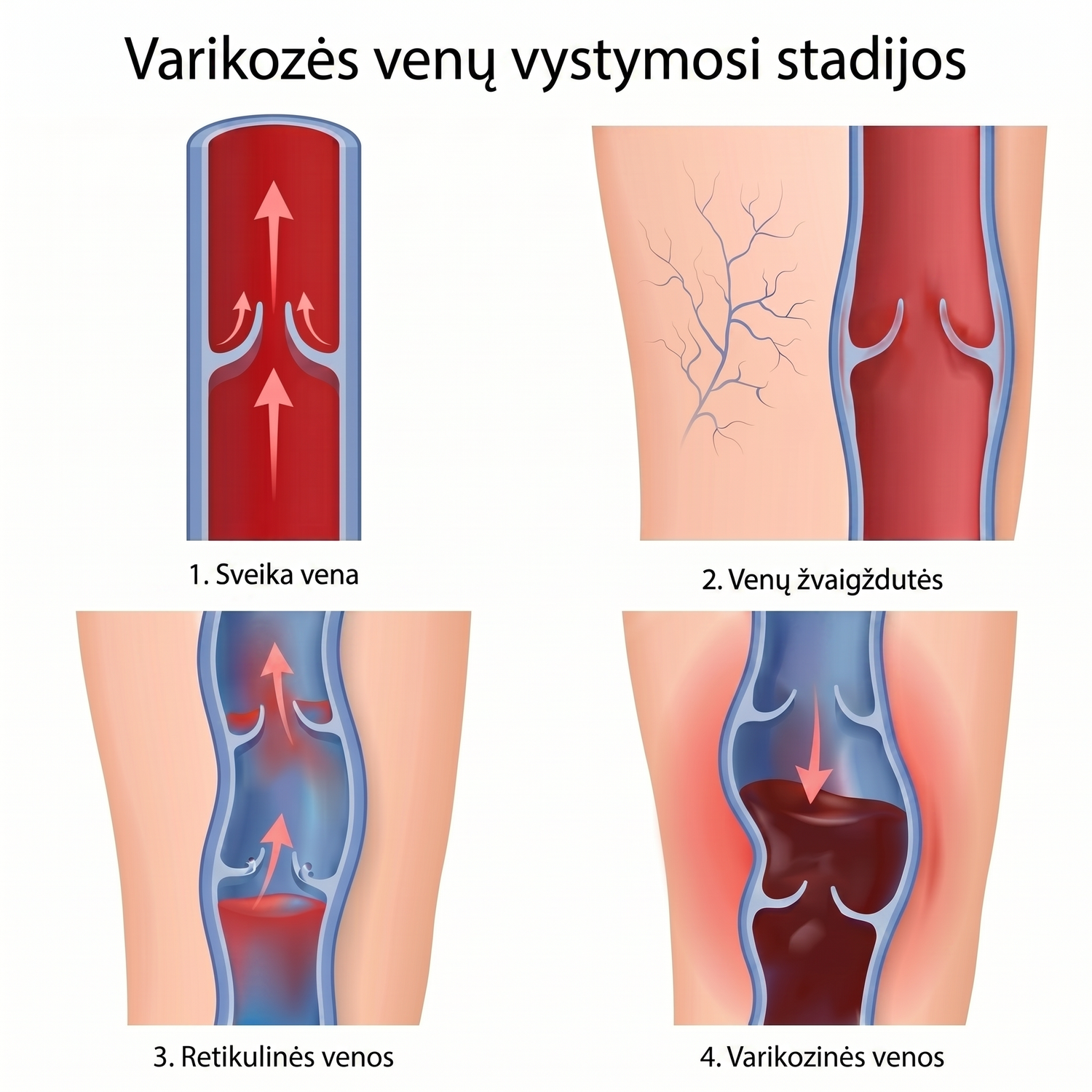 Vein anatomy diagram