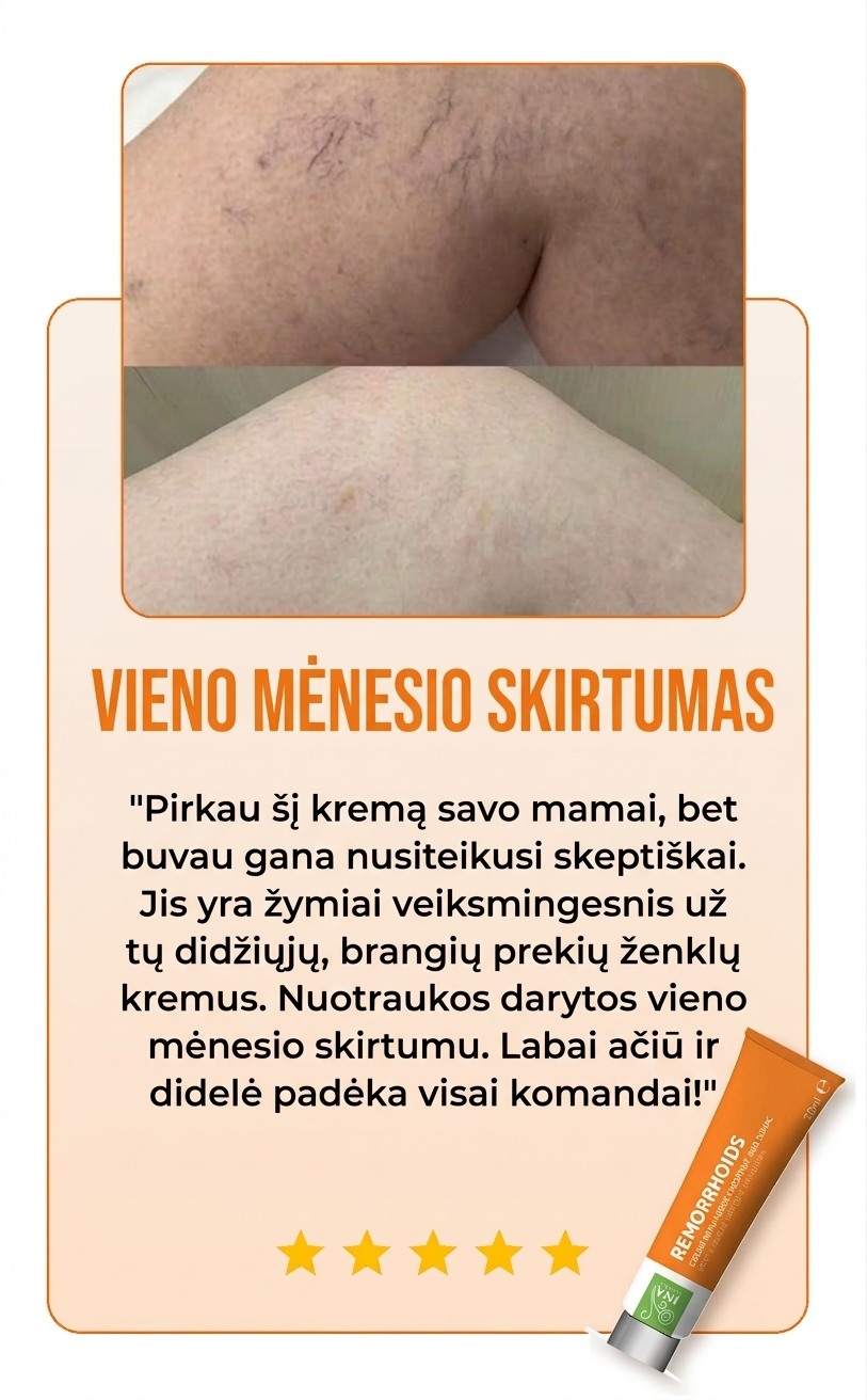 Remorrhoids review