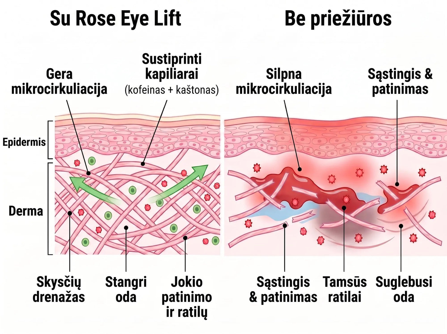 Rose Eye Lift LT t17