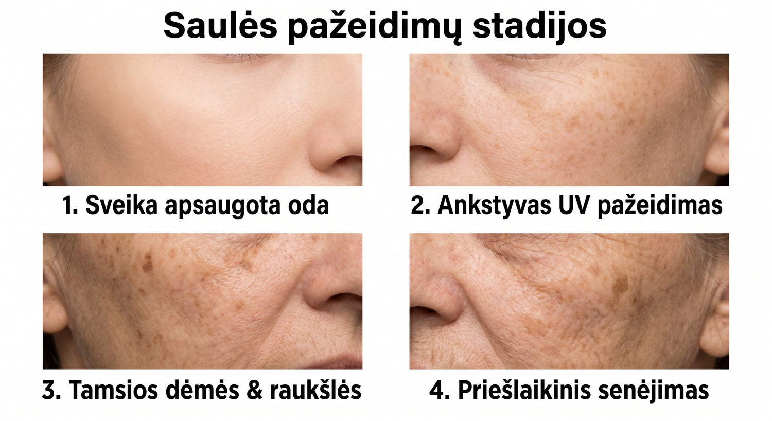 spf LT infographic