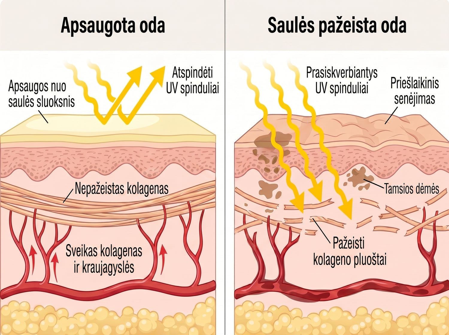 spf LT infographic